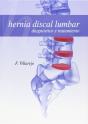 Hernia Discal Lumbar - Preview