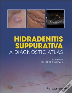 Capa do artigo Hidradenitis Suppurativa: A Diagnostic Atlas