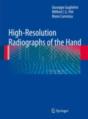 High-Resolution Radiographs Of The Hand - Preview