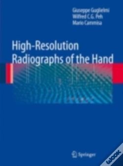 Capa do artigo High-Resolution Radiographs Of The Hand