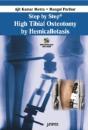 High Tibial Osteotomy By Hemicallotasis - Preview