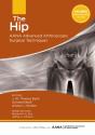 Hip - Preview