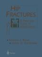Hip Fractures - Preview