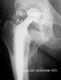 Hip Surgery - An Odyssey - Preview
