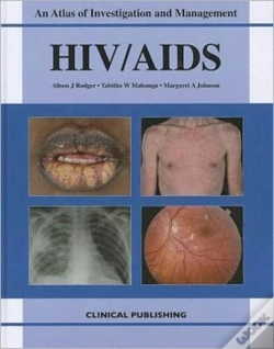 Capa do artigo Hiv/Aids