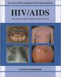 Hiv/Aids - Preview