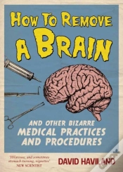 Capa do artigo How To Remove A Brain