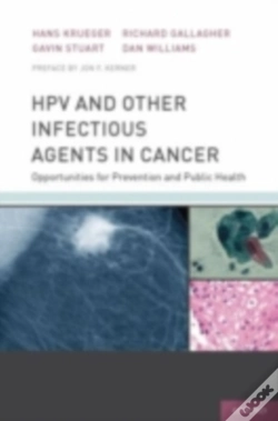 Capa do artigo Hpv And Other Infectious Agents In Cancer