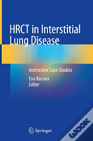 Hrct In Interstitial Lung Disease