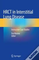 Hrct In Interstitial Lung Disease