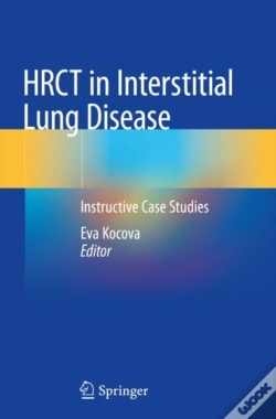 Capa do artigo Hrct In Interstitial Lung Disease