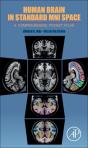 Human Brain In Standard Mni Space - Preview
