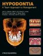 Hypodontia - Preview