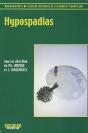 Hypospadias - Preview