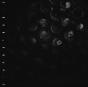 Ice Melt - Vinil - Preview