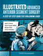 Illustrated Advanced Anterior Segment Surgery - Preview
