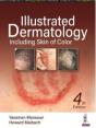Illustrated Dermatology - Preview