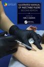 Illustrated Manual Of Injectable Fillers - Preview