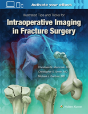 Illustrated Tips And Tricks For Intraoperative Imaging In Fracture Surgery - Preview