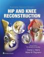 Illustrated Tips And Tricks In Hip And Knee Reconstructive And Replacement Surgery - Preview