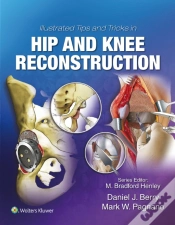 Capa do artigo Illustrated Tips And Tricks In Hip And Knee Reconstructive And Replacement Surgery