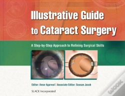 Capa do artigo Illustrative Guide To Cataract Surgery