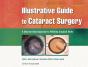 Illustrative Guide To Cataract Surgery - Preview