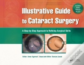 Capa do artigo Illustrative Guide To Cataract Surgery