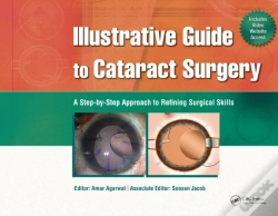 Capa do artigo Illustrative Guide To Cataract Surgery