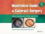 Illustrative Guide To Cataract Surgery - Preview