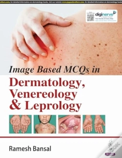 Capa do artigo Image Based Mcqs In Dermatology, Venereology & Leprology