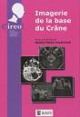 Imagerie De La Base Du Crâne - Preview