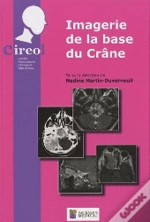 Imagerie De La Base Du Crâne