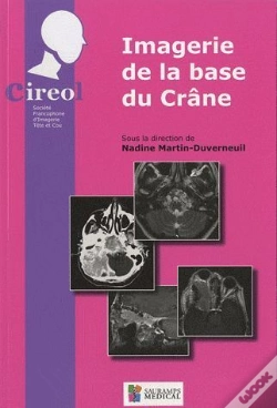 Capa do artigo Imagerie De La Base Du Crâne