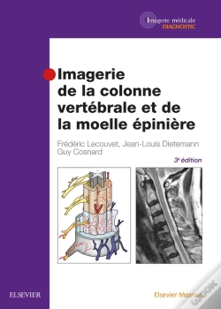 Capa do artigo Imagerie De La Colonne Vertébrale Et De La Moelle Épinière (3e Édition)
