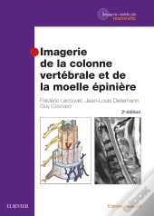 Imagerie De La Colonne Vertébrale Et De La Moelle Épinière (3e Édition)