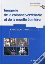 Imagerie De La Colonne Vertébrale, Moëlle Épinière