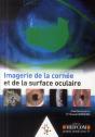 Imagerie De La Cornee Et De La Surface Oculaire - Preview