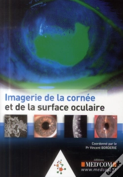 Capa do artigo Imagerie De La Cornee Et De La Surface Oculaire