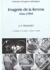 Imagerie De La Femme ; Apport A L'Irm