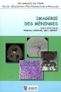 Imagerie Des Méninges - Preview