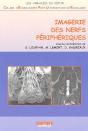Imagerie Des Nerfs Péripheriques - Preview