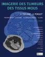 Imagerie Des Tumeurs Des Tissus Mous - Preview
