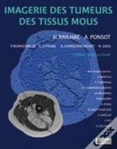 Imagerie Des Tumeurs Des Tissus Mous