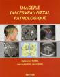 Imagerie Du Cerveau Foetal Pathologique - Preview
