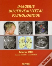 Capa do artigo Imagerie Du Cerveau Foetal Pathologique