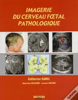 Capa do artigo Imagerie Du Cerveau Foetal Pathologique