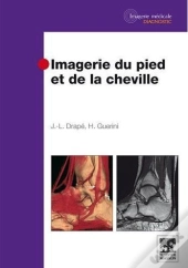 Imagerie Du Pied Et Cheville