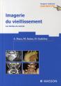 Imagerie Du Vieillissement - Preview