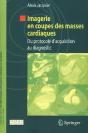 Imagerie En Coupes Des Masses Cardiaques ; Du Protocole D'Acquisition Au Diagnostic - Preview
